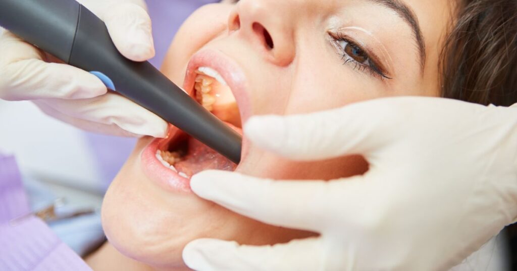 Root Canal Treatment